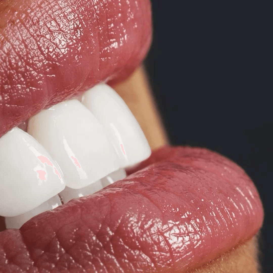 Queennails — post 6